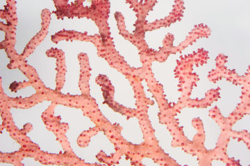 Coral IVF